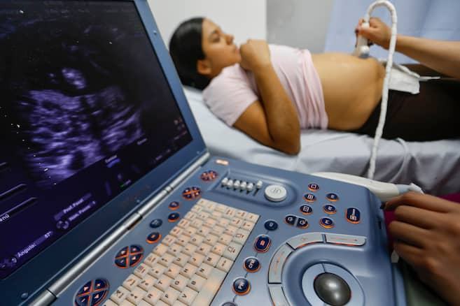 Buena noticia: los embarazos adolescentes caen; ¿por qué la derecha quiere revertirlo?